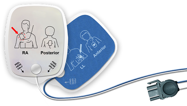 High-Quality Heartsync AED Pads & Defibrillator Electrodes from Nissha ...