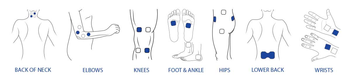 Electrode Placement for Electric Stimulation Charts