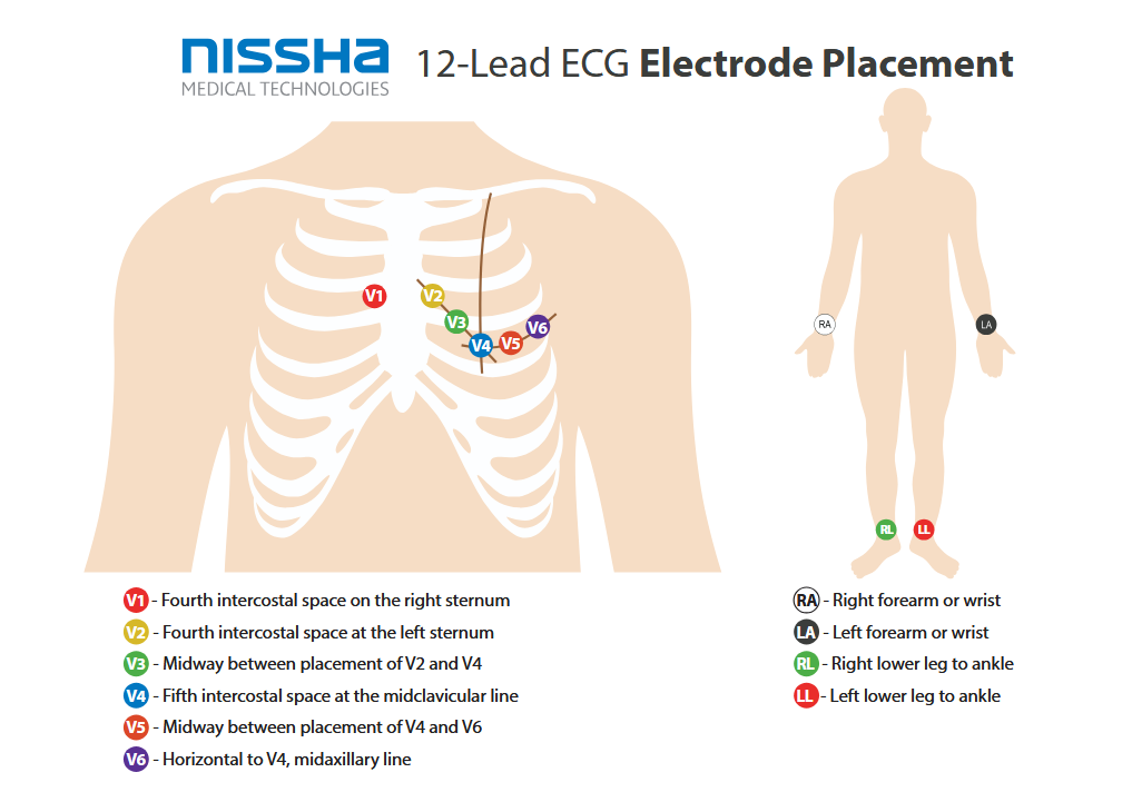<p>ECG 12-Lead Placement</p>